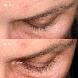Lashbond™ - Serum do rzęs