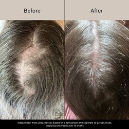 Pitta Growth Serum - Serum na porost włosów
