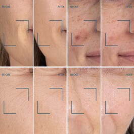 Blue Retinol Serum Night - Serum do twarzy na noc