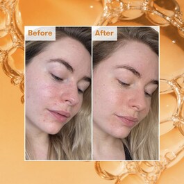READY STEADY GLOW DAILY AHA TONIC - Tonik z kwasami 