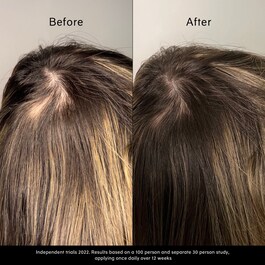 Pitta Growth Serum - Serum na porost włosów