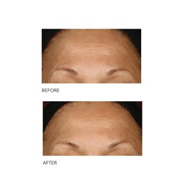 Alpha Beta® - Codzienny peeling o intensywnej formule