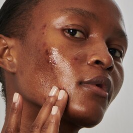 20% Niacinamide Serum - Serum do twarzy