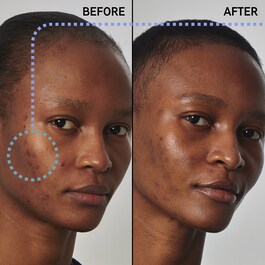 20% Niacinamide Serum - Serum do twarzy