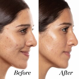 A+ - Serum z retinoidami