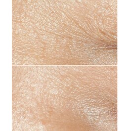 Smart Clinical Repair™ Wrinkle Correcting Cream - Krem do twarzy