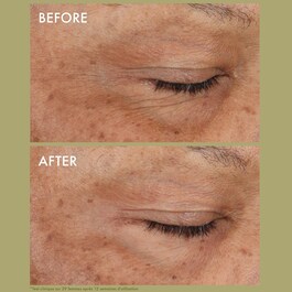 Plantscription™ Wrinkle Correction - Krem pod oczy z retinolem