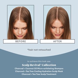 Scalp Revival Charcoal - Kuracja do skóry głowy