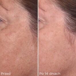 Rapid Dark Spot Correcting Serum - Serum do twarzy
