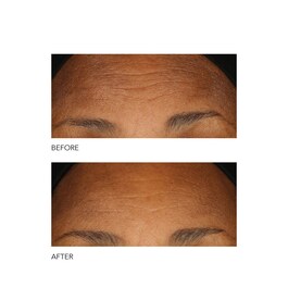 Alpha Beta® - Codzienny peeling o intensywnej formule