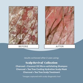 Scalp Revival Charcoal - Szampon złuszczający