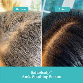 SahaScalp™ – Kojące serum z owocami amla