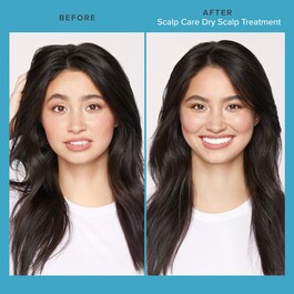Scalp Care Dry Scalp Treatment - Balancing Treatment For Scalp