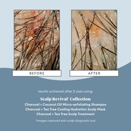 Scalp Revival Charcoal - Kuracja do skóry głowy