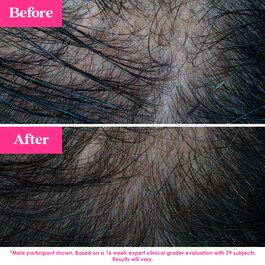 GrandeHAIR Enhancing Serum – Serum upiększające włosy