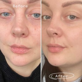 Huile de Rosier Sauvage BioRegenerate - Olejek z dzikiej róży