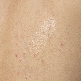 Sérum Corps à l'Acide Salicylique 0.5% - Serum na niedoskonałości do ciała