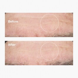 Kwas Hialuronowy 2% + B5 - Serum Nawilżające