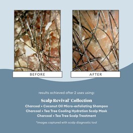 Scalp Revival Charcoal - Szampon złuszczający