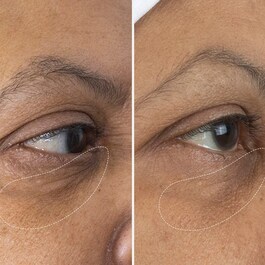 The Eye Cream Nomad – Krem pod oczy