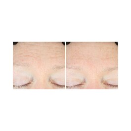 Vitamin C + Lactic - Pielęgnujące serum nawilżające
