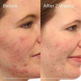 Clarifying Cleanser - Żel oczyszczający do twarzy