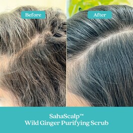 SahaScalp™ Reset Kit - Zestaw do skóry głowy