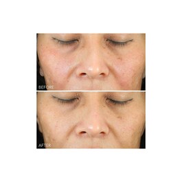 Vitamin C + Lactic - Pielęgnujące serum nawilżające