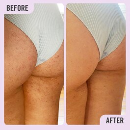 KP Bump Eraser Body Scrub with 10% AHA - Peeling do ciała z kwasami AHA