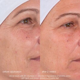 Dynamic skin retinol Sérum – Serum przeciwzmarszczkowe