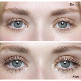 Duo Lift + Light Eye - Duet dla oczu