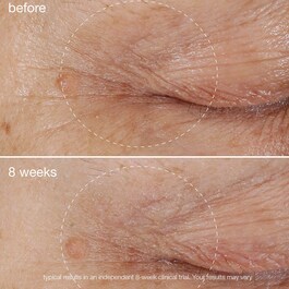 Biolumin-C Eye Serum - Rozświetlające serum do konturu oczu z witaminą C