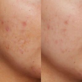 B3 Nice 10% Niacynamide - Serum rozświetlające