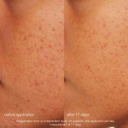 Daily Microfoliant – Łagodny peeling enzymatyczno-mechaniczny