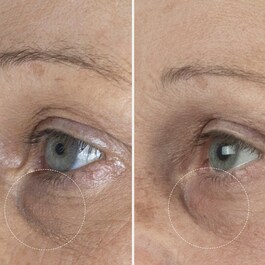 The Eye Cream Nomad – Krem pod oczy