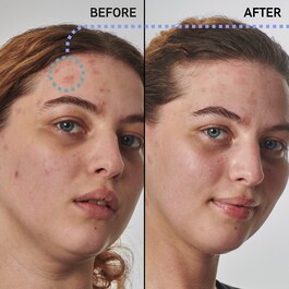 10% Urea Moisturizer - Serum do twarzy
