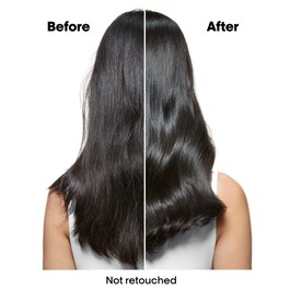 Scalp Advanced szampon przeciwłupieżowy