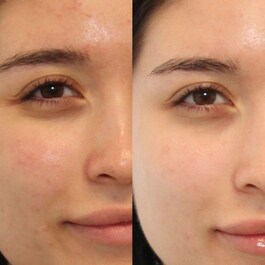 Oil and Pore Control Mattifier SPF 45 - Krem nawilżająco-matujący 