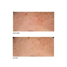 Alpha Beta® - Codzienny peeling o uniwersalnej formule