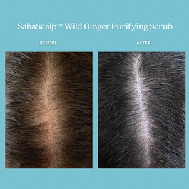 SahaScalp™ – Peeling oczyszczający z dzikim imbirem