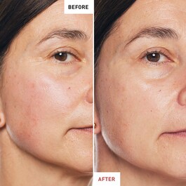 Skin Therapy - Olejek na noc